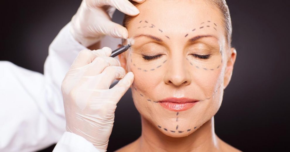 Aesthetic surgery of the face