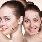 5 Common Myths About Cosmetic Surgery - Ladner Facial Plastic Surgery:  Keith Ladner, MD